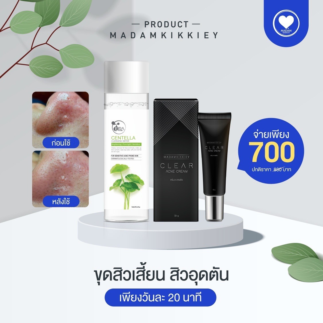 18เซต4 18เซต4