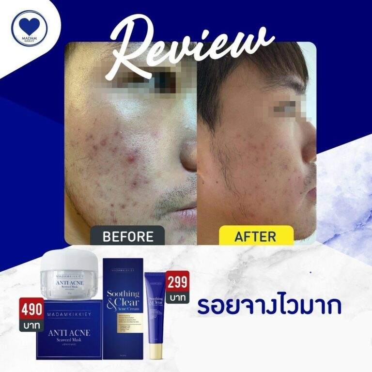 19.1รีครีม1