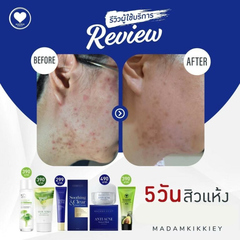 19.2 รีครีม2