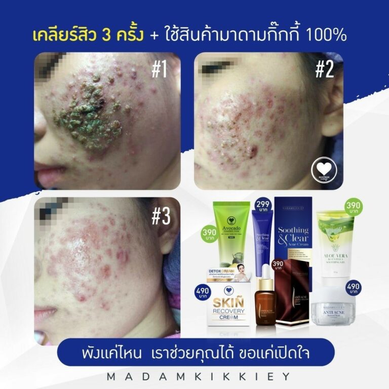 19.3 รีครีม3
