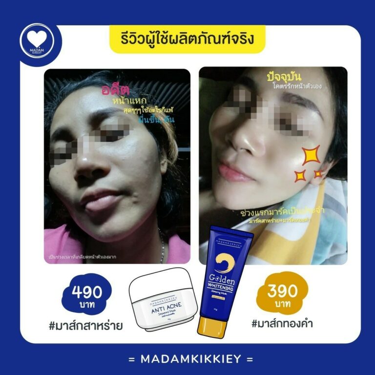19.4 รีครีม4