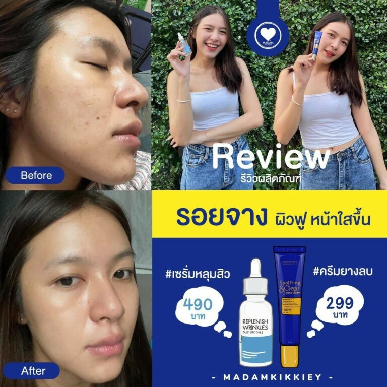 19.5 รีครีม5