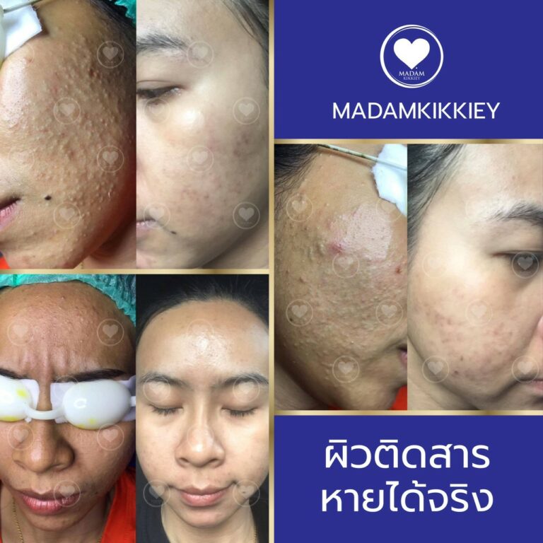 9.1 ติดสาร1