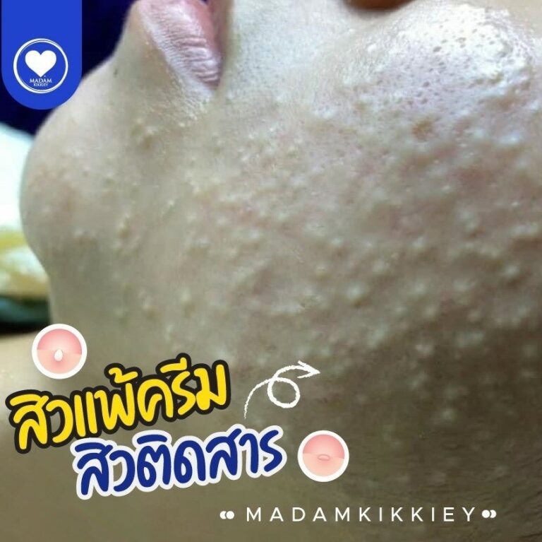 9.2 ติดสาร2
