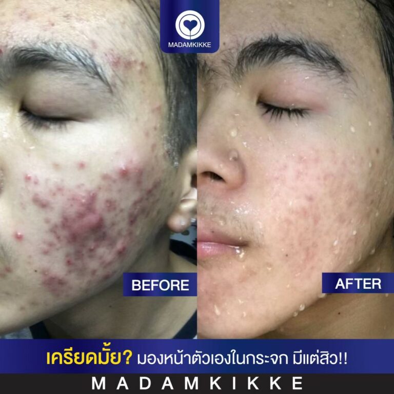9.3 ติดสาร3